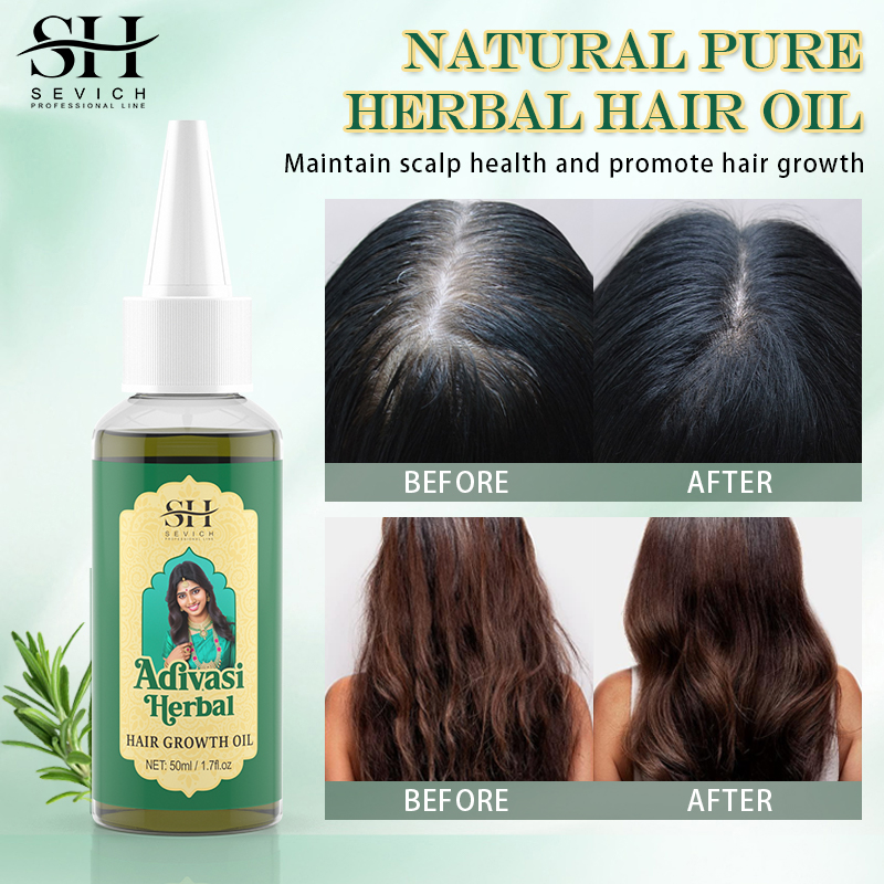 Huile de croissance des cheveu - Ayurvedic & Herbal Wellness Kits avis et prix