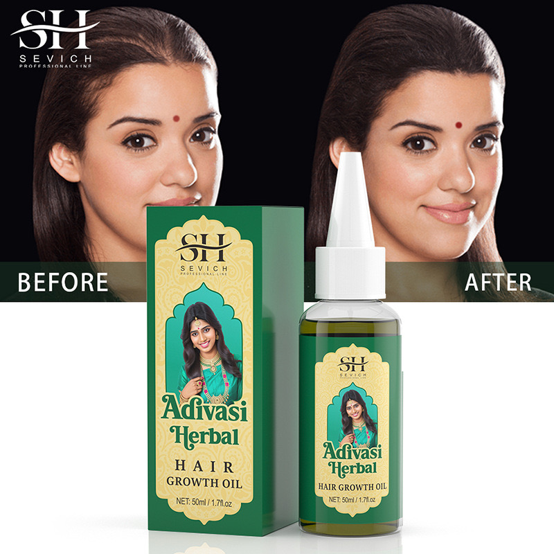 50ml Original inde huile Adiva - Ayurvedic & Herbal Wellness Kits avis et prix